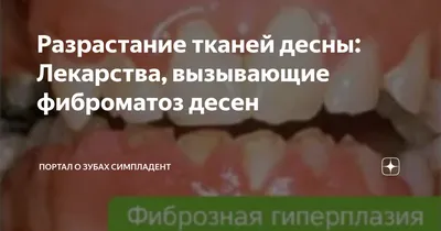 Аугментация кератинизированной десны