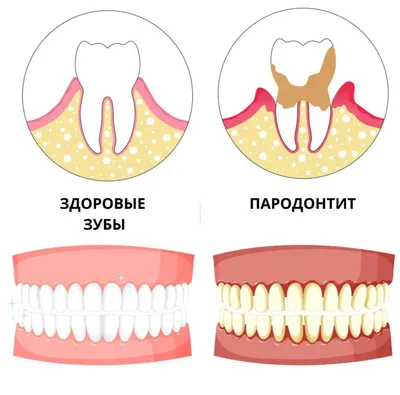 Периферическая одонтогенная фиброма у собаки | Ординарные заметки | Дзен