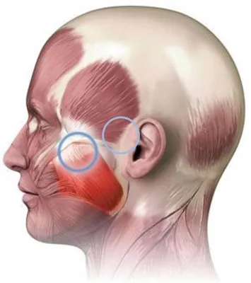 Гипертонус жевательных мышц | Портал о зубах Симпладент | Дзен