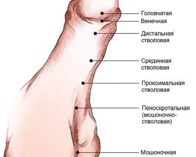 Венечная форма гипоспадии у детей - операция, лечение в центре андрологии в  Москве