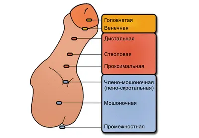 гипоспадия #детскаяурология #urology... - Moscow_urocenter | Facebook