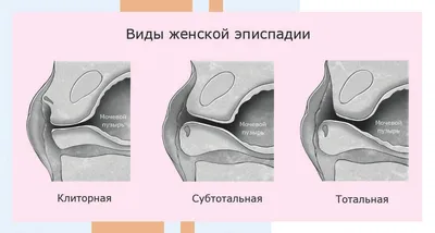 Обрезание у мужчин: зачем делают, схема, плюсы и минусы, сколько стоит  циркумцизия