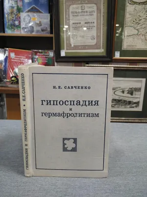 СРАВНИТЕЛЬНЫЕ ДАННЫЕ РЕЗУЛЬТАТОВ ОПЕРАТИВНОГО ЛЕЧЕНИЯ ДЕТЕЙ ЗАДНЕЙ ФОРМЫ  ГИПОСПАДИИ У МАЛЬЧИКОВ – тема научной статьи по клинической медицине  читайте бесплатно текст научно-исследовательской работы в электронной  библиотеке КиберЛенинка