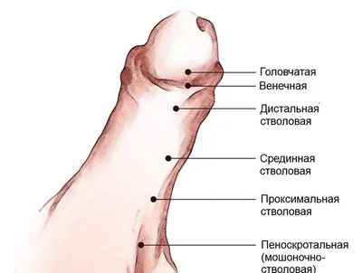 Сравнительный анализ методов лечения дистальной формы гипоспадии у детей –  тема научной статьи по клинической медицине читайте бесплатно текст  научно-исследовательской работы в электронной библиотеке КиберЛенинка