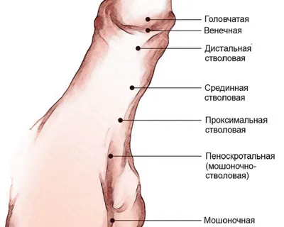 Гипоспадия | Рудин Юрий Эдвартович - Детская урология-андрология