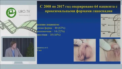 гипоспадия #детскаяурология #urology... - Moscow_urocenter | Facebook