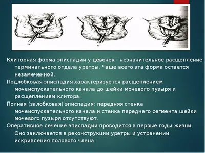 Аномалии развития половых органов у мальчиков - презентация, доклад, проект