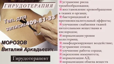 Гирудотерапия | Услуги - МЦ Панацея