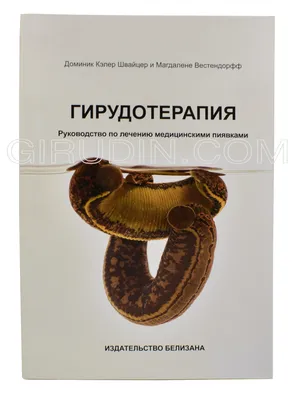 Гирудотерапия
