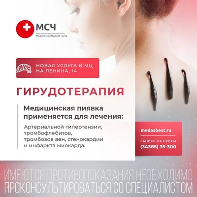 Гирудотерапия - диагностика и лечение заболеваний в Москве в клинике АвроМед