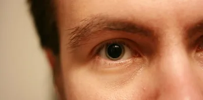 Дикая история про глаза наркомана
