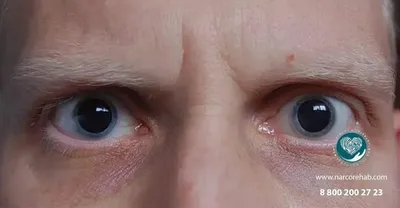 Почему у всех наркоманов красные глаза? | Обучение за границей + РФ Smapse  | Дзен