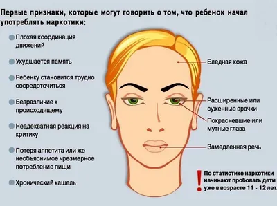 Ответы Mail.ru: Сказали что глаза как у наркомана