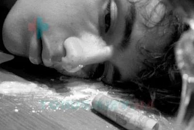 Девушка, вырвавшая себе глаза под наркотиками, показала, как выглядит после  установки протезов