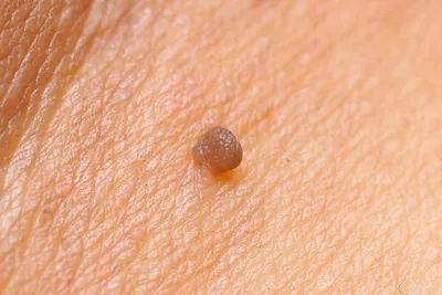 Болезни печени у крупного рогатого скота - Agrovesti.net | АПК