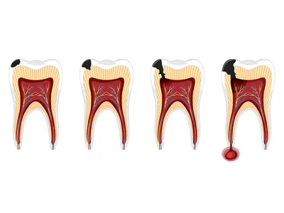 dentalika42