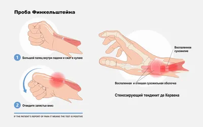 травма скакательного сустава задней конечности, очень нужна помощь !!! —  Травмы суставов и связок — Ветеринарный форум