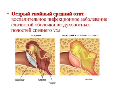 Отит у кошек: лечение, симптомы и признаки, фото, как выглядит
