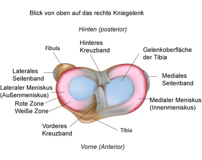 Разрыв заднего рога мениска - Wirbelsäulen und Gelenke Zentrum München