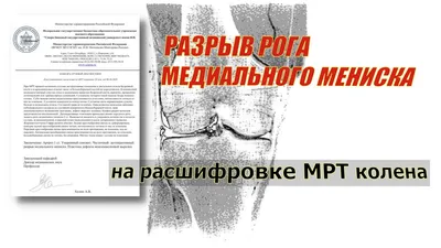 Операция при разрыве мениска | Фото до и после, операция, отзывы, лечение,  реабилитация и восстановление