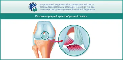 МРТ коленного сустава в Новосибирске – цены в клинике «МРТ Альянс»