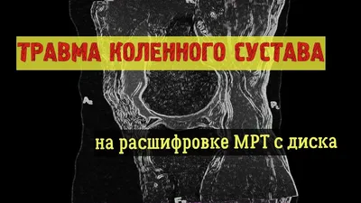 Разрыв мениска: причины, симптомы и лечение в статье травматолога Сапунков  С. А.