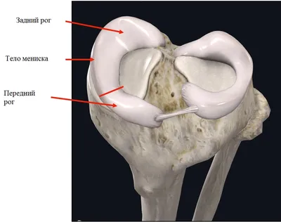 Горизонтальный разрыв заднего рога медиального мениска - Травматология и  ортопедия - 4.09.2013 - Здоровье Mail.ru