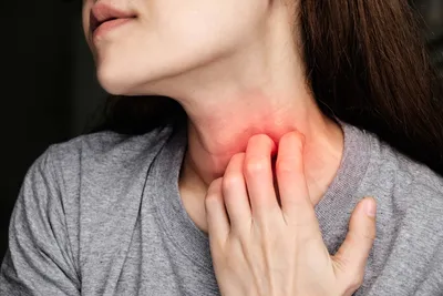 Грибок в горле - симптомы и лечение микоза горла | Лечим Грибок
