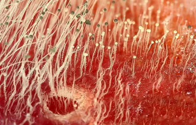 Как выглядит грибок на коже | Медицинская эстетическая косметология