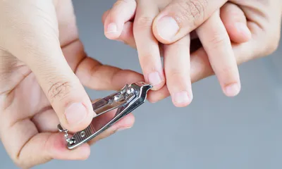 Грибок ногтей у детей: почему родителям важно быть на чеку — Медицинская  лаборатория IMD
