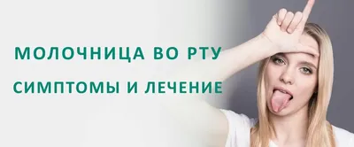 Молочница во рту: причины и лечение - стоматология Блеск Новосибирск