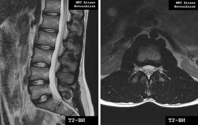 МРТ позвоночника в Купчино