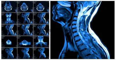 МРТ позвоночника по доступной цене — (клиники Di Центр)