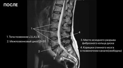 Врач, который не смотрит МРТ позвоночника пациента | Пикабу