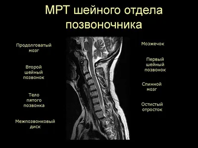 МРТ шейного отдела позвоночника в Киеве — цена на МРТ шеи, мягких тканей  шеи в СДС