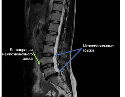 MRI - jaseng.ru