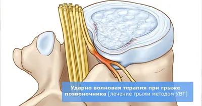 МРТ диагностика и лечение боли в спине Хмельницкий Ультрадиагностика  записаться