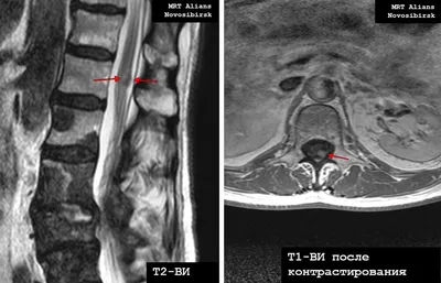 МРТ позвоночника платно в Минске - Имред