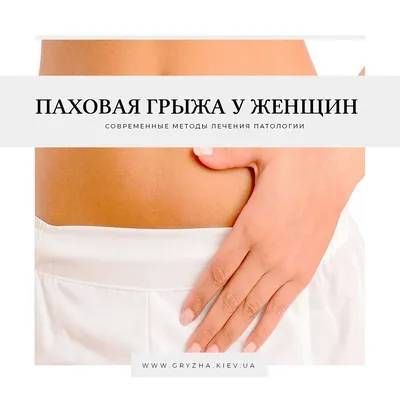 ✓ Паховая грыжа у женщин и современные методы лечения патологии ⋆ 2023