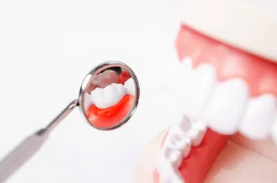По всему рту появилась сыпь в виде красных точек - Стоматология - Форум  стоматологов (стомотологический форум) - Профессиональный стоматологический  портал (сайт) «Клуб стоматологов»