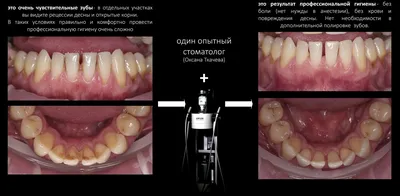 По всему рту появилась сыпь в виде красных точек - Стоматология - Форум  стоматологов (стомотологический форум) - Профессиональный стоматологический  портал (сайт) «Клуб стоматологов»