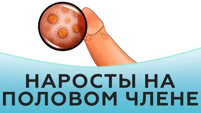 Баланопостит — причины, признаки, симптомы, осложнения, диагностика и  лечение воспаления крайней плоти в 100med
