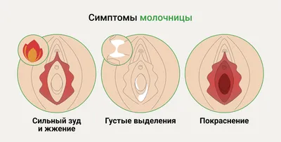 Красный плоский лишай - Дерматологическая патология - Справочник MSD  Профессиональная версия