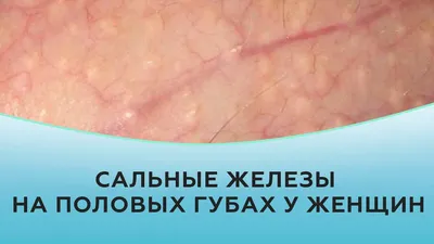 Баланит - Клиники Чайка