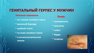 Кожные заболевания: герпес - Клиника ТРИНИТИ (Москва)