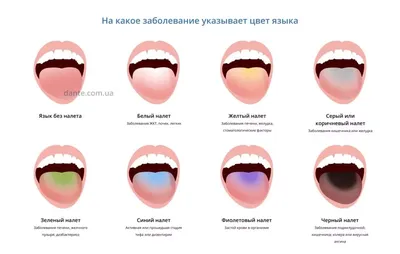 Пирсинг языка – цены в Москве, фото и особенности процедуры