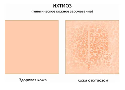 Royal Canin (вет. диета) - Сухой корм для собак при дерматозе SKIN CARE SK  23 купить в Москве по цене 6 345 руб.