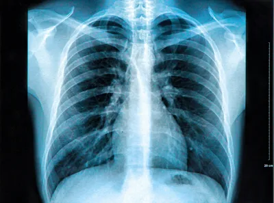 Mobile X-ray Services - TridentCare