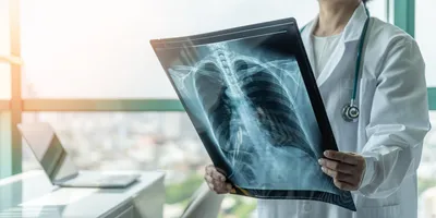 What Do Chest X-Rays Show?