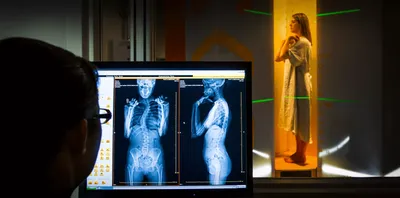 True-to-Life Human X-Rays - Montessori Services
